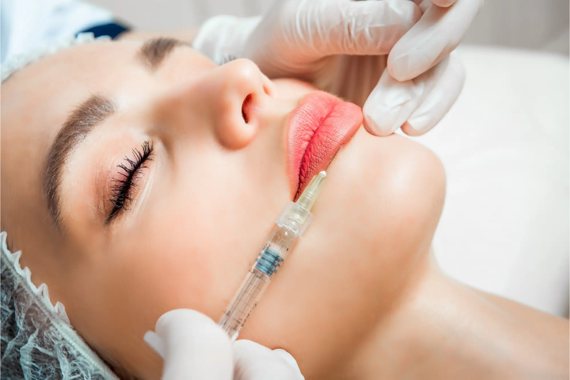 Dermal Fillers Treatment